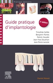 Guide pratique d implantologie