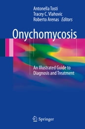 Onychomycosis