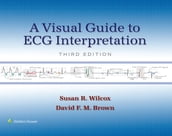 A Visual Guide to ECG Interpretation